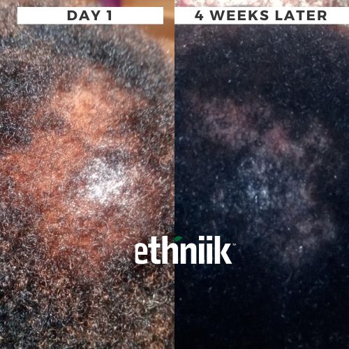 Ayurgro Powder - Image 3