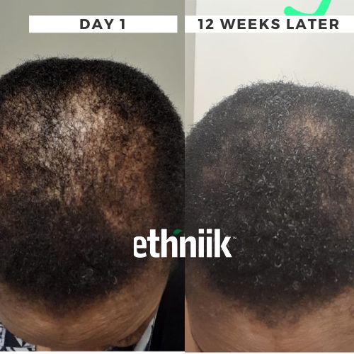 Ayurgro Powder - Image 5