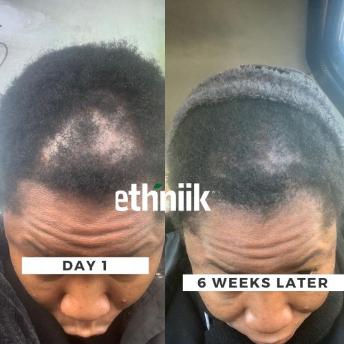 Ayurgro Powder - Image 2